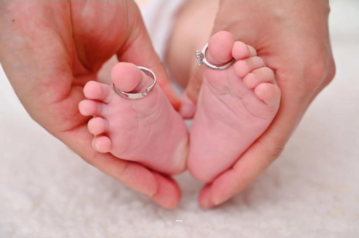 保山孕妇怎样预防妊娠纹